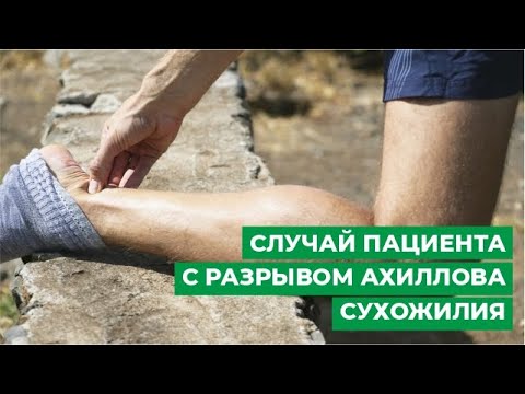 Видео: Разрыв ахиллова сухожилия: лечение и реабилитация. Случай пациента.