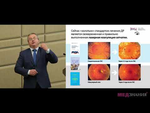Видео: «Ретинопатия как осложнение сахарного диабета 2 типа» Д.В. Липатов
