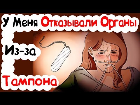 Видео: У Меня Отказывали Органы Из-за Тампона (История из Жизни)