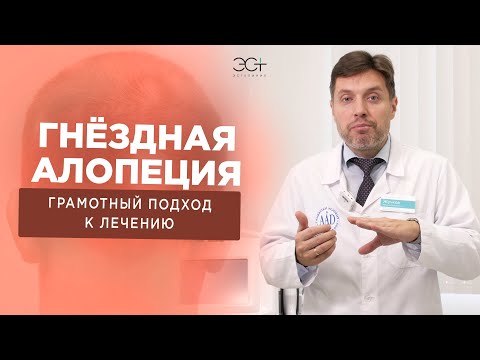 Видео: ГНЕЗДНАЯ АЛОПЕЦИЯ. Почему выпадают волосы и как с этим бороться?