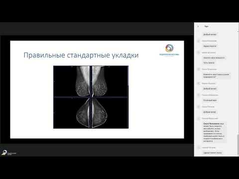 Видео: Типичные ошибки при выполнении маммографических исследований