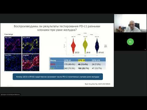 Видео: Лучшее по материалам конференций ASCO 2022, посвященным опухолям желудочно-кишечного тракта