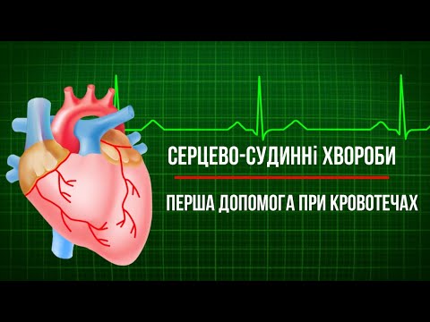 Видео: Серцево-судинні захворювання та їх профілактика. Перша допомога при кровотечах