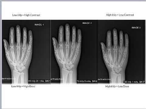 Видео: кВп и контраст