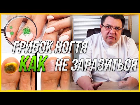 Видео: Грибок ногтя - как не заразиться. Доктор Косов.