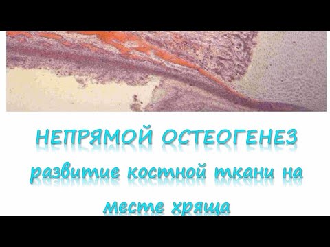 Видео: НЕПРЯМОЙ ОСТЕОГЕНЕЗ