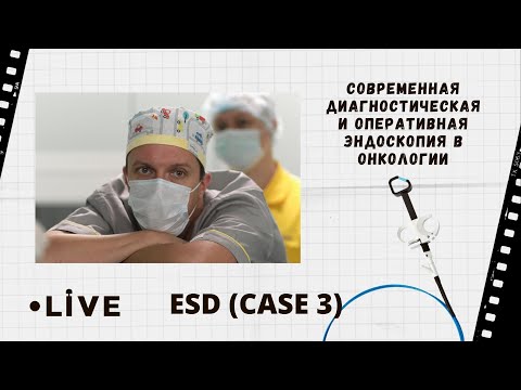 Видео: Современная диагностическая и оперативная эндоскопия в онкологии. Live из Архангельска: ESD