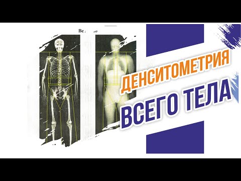 Видео: Денситометрия. Измеряем жир, мышцы и кости с точностью до грамма