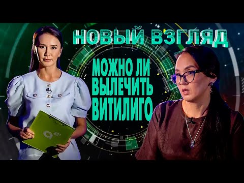 Видео: Новый взгляд: можно ли вылечить витилиго?