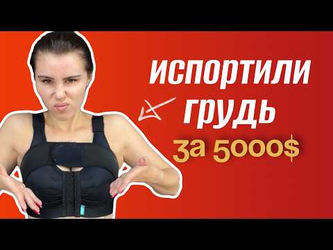 Видео: МОЙ (ПЕЧАЛЬНЫЙ)  ОПЫТ МАММОПЛАСТИКИ