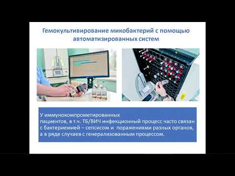 Видео: Быстрые методы диагностики туберкулеза и определения лекарственной чувствительности возбудителя