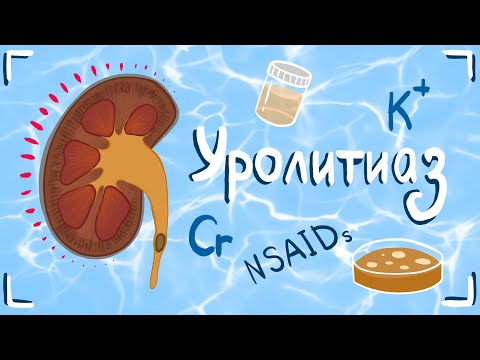 Видео: Уролитиаз