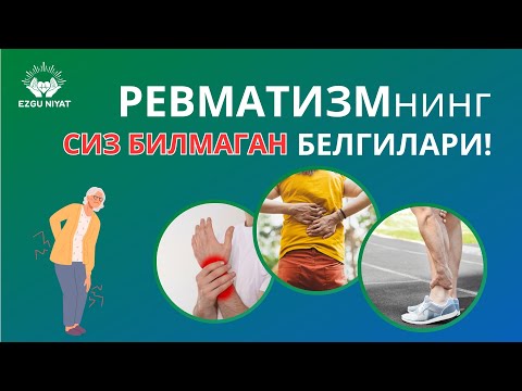 Видео: РЕВМАТИЗМнинг сиз билмаган белгилари!