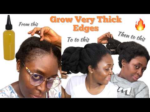 Видео: Попрощайтесь с облысением и ломкостью волос | Лучшее лечение облысения