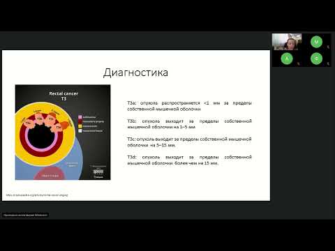 Видео: Подготовка к экзамену ESMO. Опухоли ЖКТ