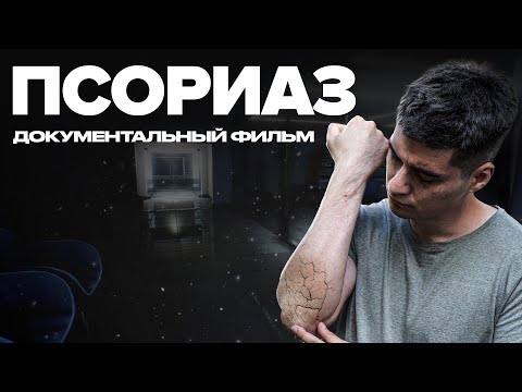 Видео: Псориаз | Документальный фильм