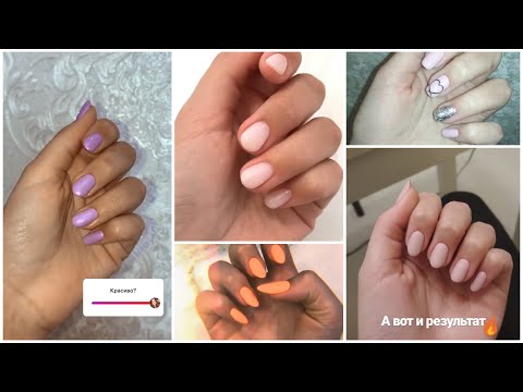 Видео: Как Быстро Отрастить Ногти? /// моя история