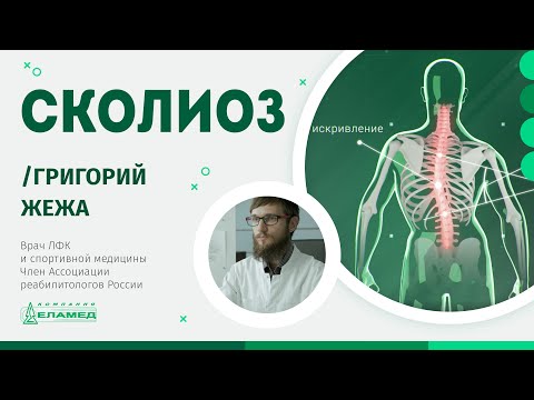 Видео: Сколиоз у взрослых. Симптомы сколиоза, степени и лечение | Григорий Жежа