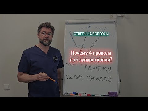 Видео: Проколы при лапароскопии. Почему четыре?