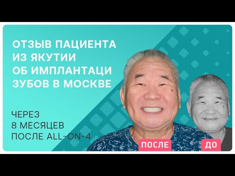 Видео: Насколько сильно имплантация зубов поменяет жизнь? Моя изменилась на 180 градусов!