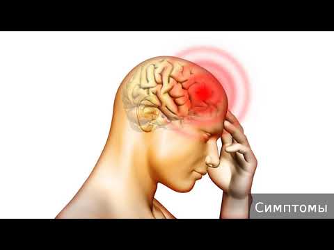 Видео: Менингит. Как лечить менингит.
