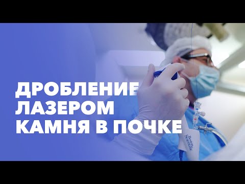 Видео: Удаление камня из почки: дробление лазером при помощи гибкого инструмента