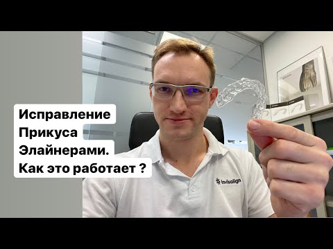 Видео: Элайнеры для исправления прикуса в Ульяновске. Как изготавливаются планируются выглядят. Стас Белоус