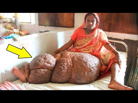 Видео: 8 СТРАННЫХ ЛЮДЕЙ, В СУЩЕСТВОВАНИЕ КОТОРЫХ ВЫ НЕ ПОВЕРИТЕ