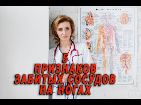 Видео: 5 признаков забитых сосудов ног. Кардиолог. Анна Кореневич