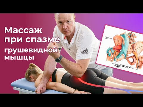 Видео: Синдром грушевидной мышцы. Массаж Седалищного нерва