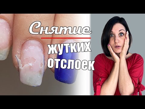 Видео: Жуткие отслойки, как делать снятие отслоек.