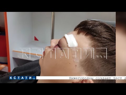 Видео: Ученика в школе избили так, что он оказался в больнице с множественными переломами костей лица