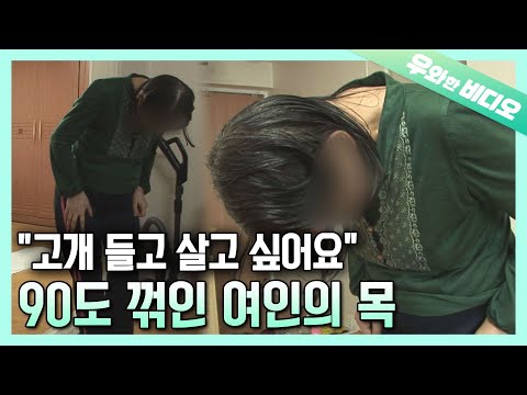 Видео: Согнутая на 90 градусов шея, женщина, которая не может поднять голову ...