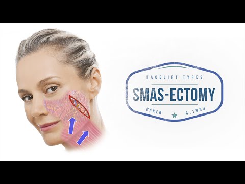 Видео: Подтяжка лица 101: различия между разными типами подтяжки лица | Aesthetic Minutes #ПодтяжкаФейса