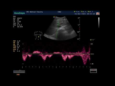 Видео: Отработка аккредитационных сценариев по трансабдоминальному ультразвуковому исследованию