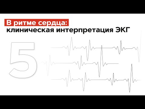 Видео: Значение ЭКГ у лиц с факторами риска ИБС. 16.06.22