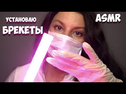 Видео: #АСМР / УСТАНОВКА БРЕКЕТОВ / новые Триггеры для СНА