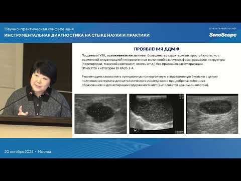 Видео: Дисгормональная дисплазия молочных желез в практике врача ультразвуковой диагностики. Данзанова Т.Ю