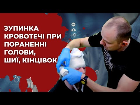 Видео: Зупинка кровотечі при пораненні голови, шиї, кінцівок.