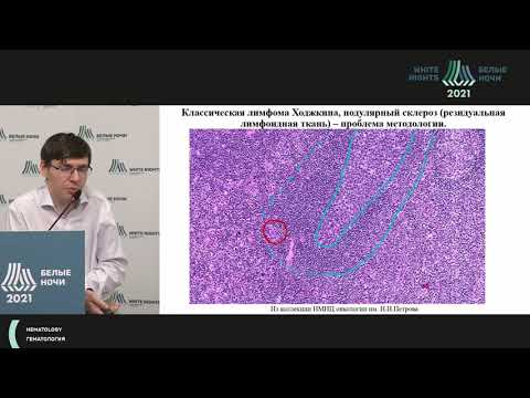 Видео: Микроокружение как прогностический фактор классической лимфомы Ходжкина