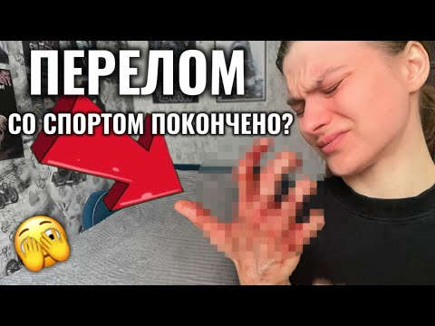 Видео: СЛОМАЛА РУКУ / СОРЕВНОВАНИЯ