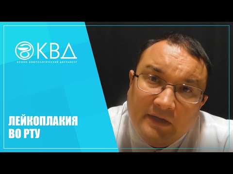Видео: 1355  Лейкоплакия во рту