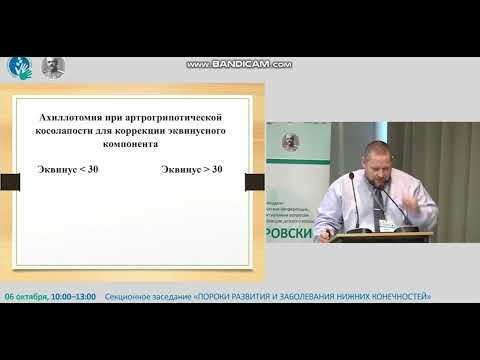 Видео: Частные вопросы лечения косолапости по методу Понсети. Готовы ли мы к неожиданностям?