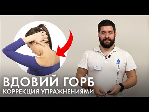 Видео: Вдовий горбик: как избавиться? Упражнения от холки на шее для женщин и мужчин