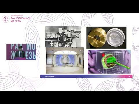 Видео: Современные технологии лучевой терапии при раке молочной железы: IMRT, Vmat, протоны