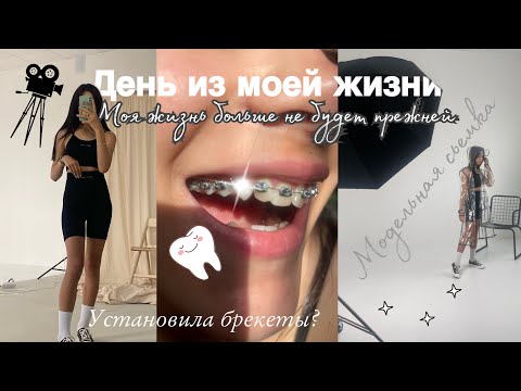 Видео: Возвращение на канал?😱 ПОСТАВИЛИ БРЕКЕТЫ🦷МОДЕЛЬНЫЕ СЬЕМКИ🎥