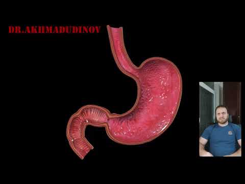 Видео: Гастростомия по Кадеру. Ахмадудинов А.М.