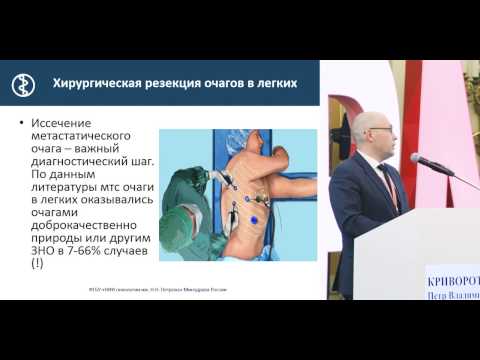 Видео: Хирургия при раке молочной железы IV стадии