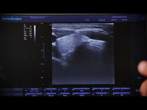 Видео: S2N 03 Настройки B режима