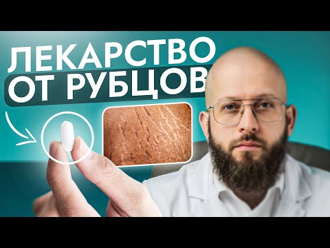 Видео: Как влияют лекарственные препараты на формирование рубцов. Коррекция Рубцов